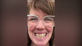 中年女士用自拍记录箍牙历程，只要你想变得更好，什么时候开始都不算晚