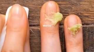 Mẹo hay về nha đam Phần 2