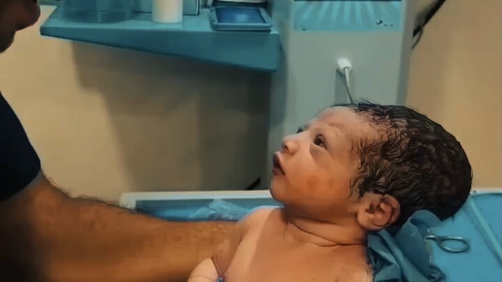 Explanation of the Infant Moro Reflex Test