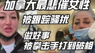 Người phụ nữ đáng thương nhất Canada: Bị quấy rối, theo dõi, làm việc tốt lại bị đánh đến biến dạng 