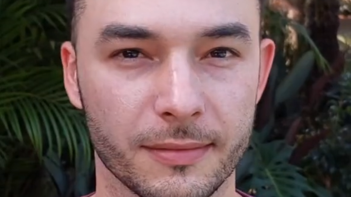 A foreign guy documents the changes over a year after getting a hair transplant 😂