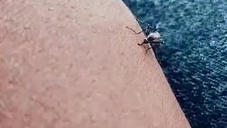 哈哈哈哈哈真正的皮糙肉厚