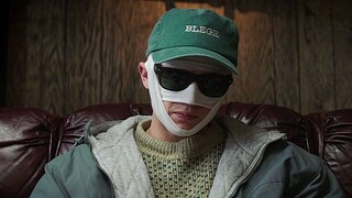 The man looks so handsome! Everyone who sees him will be so handsome! He was forced to put a bandage