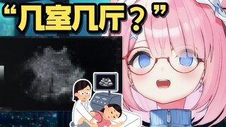 หลังจากอัลตราซาวนด์บี ส่วนที่เป็นความลับที่สุดก็ถูกแสดงให้ผู้ชมเห็น...