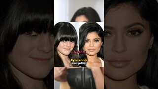 CELEBRITIES WHO HAD PLASTIC SURGERY VERY EARLY #shorts