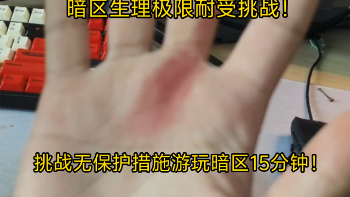 Challenge: Play Dark Zone for 15 Minutes Without Any Protective Gear!