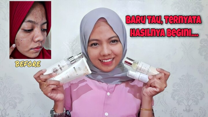REVIEW GLAMIONE SKINCARE, pokoknya BEST ter the Best