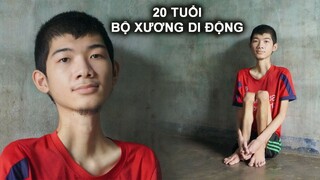 Sau Ca Mổ Em Trai Biến Thành Bộ Xương Di Động | Phần 2