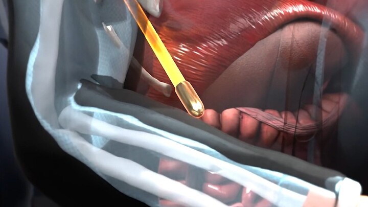 总统被刺杀之谜