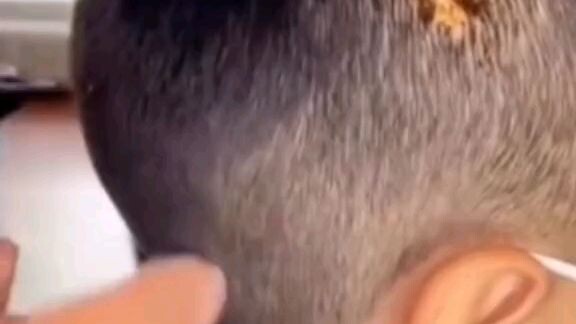 Hair grow