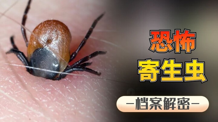 3 Terrifying Parasites: Devour Your Brain, Suck Your Bone Marrow, and Grow Up to 21 Meters Long—Once