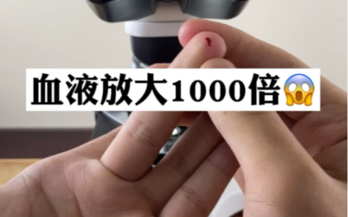 Máu phóng to