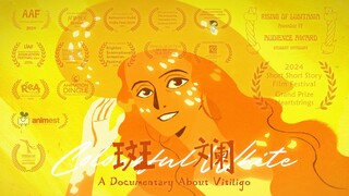 《斑斓》/Colourful White：关于白癜风的动画纪录片【第七届寻光小宇宙奖】