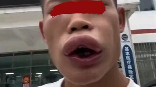 调戏蜜蜂，被吻了！快乐并没有消失，而是转移到了我的脸上！