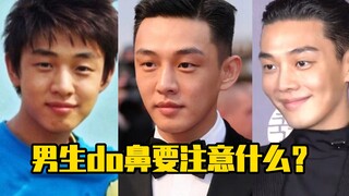 Nam giới cần lưu ý điều gì khi phẫu thuật mũi?