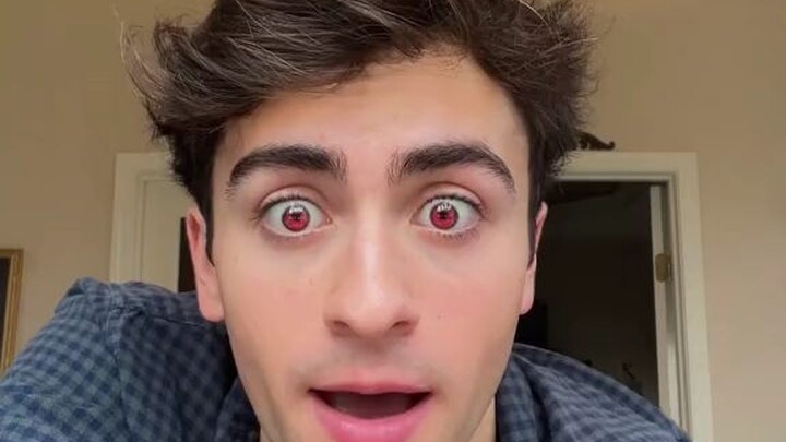 Tiktoker had a fangs and Red eyes