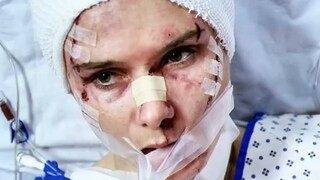 明明是女孩遭到了侵犯，结果医生却对歹徒捏了把汗