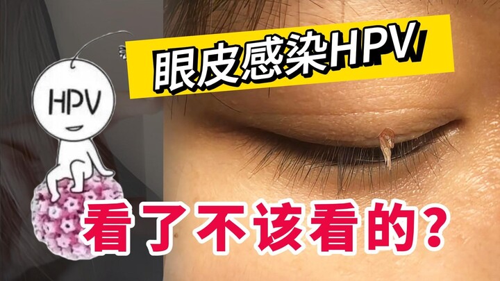 【แพทย์ให้ความรู้】หนุ่มสาววัย 20 กว่าปี มีติ่งเนื้อเล็กๆ ขึ้นบ่อย แบบนี้เกิดจากไฟธาตุแรง หรือดูสิ่งที