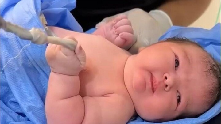 The doctor was cutting the newborn’s umbilical cord, but to everyone’s surprise, the baby panicked a