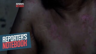 Lalaking nakakubli sa dilim nang 22 taon, ano ang kondisyon? (Full episode) | Reporter's Notebook