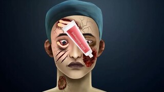 Siswa yang merawat infeksi zombie berubah menjadi anak laki-laki tampan