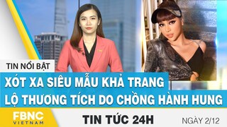 Tin tức 24h mới nhất 2/12 | Xót xa siêu mẫu Khả Trang lộ thương tích do chồng hành hung | FBNC