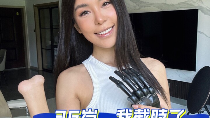 Dari olahraga ekstrem keliling dunia hingga amputasi