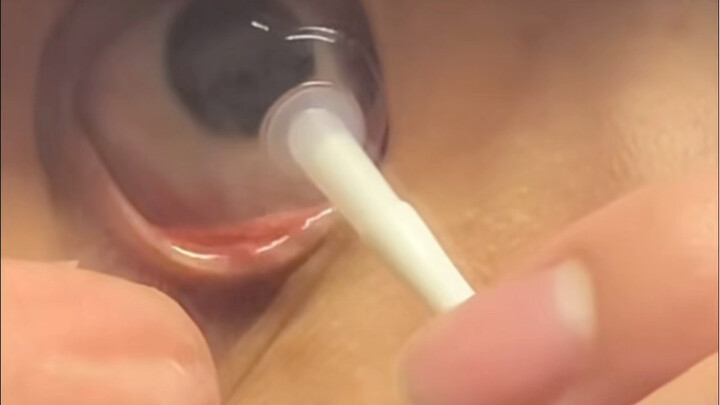 A beginner’s first time wearing contact lenses.