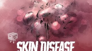 Skin Disease - DJ Redrum