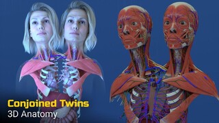 อนิเมชัน 3D ให้ความรู้: คนที่มีสองหัวในร่างเดียว ใช้ชีวิตและดำรงอยู่ได้อย่างไร?