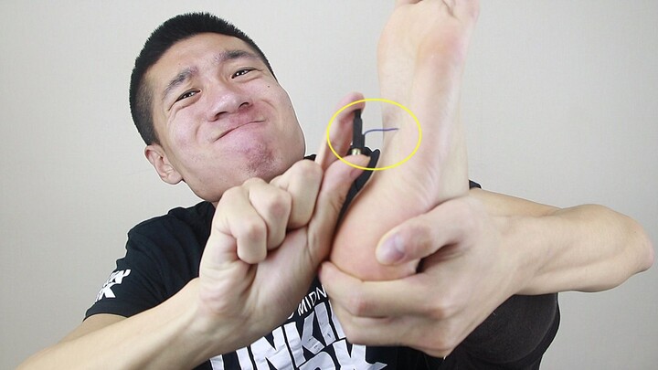 Dùng bộ kích lửa bật lửa chích điện vào lòng bàn chân, tự làm liệu pháp điện cho mình