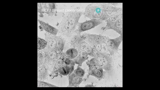 Long-term time lapse imaging of breast cancer cells (MCF7)