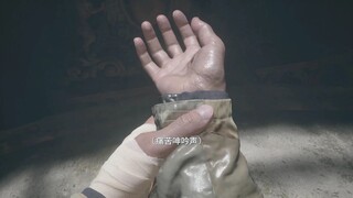 The Broken Hand Is Just Your Lie