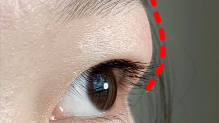 What’s the secret? Puffy eyes finally get eliminated…