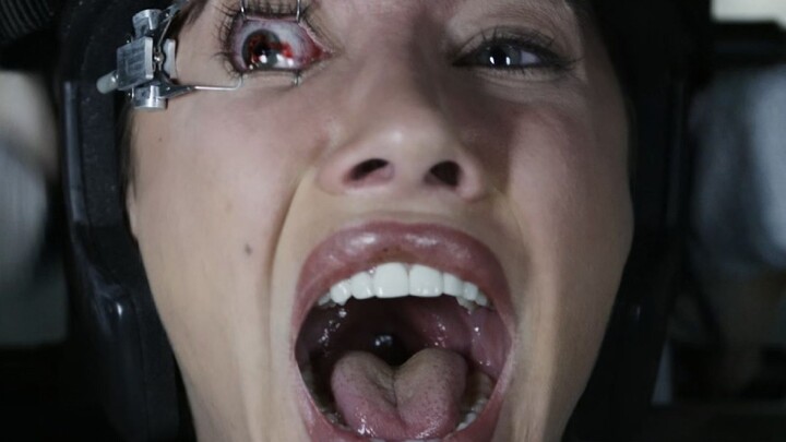 Girl Undergoes Myopia Surgery, Only to Have the Machine Suddenly Malfunction—Laser Blows Right Throu