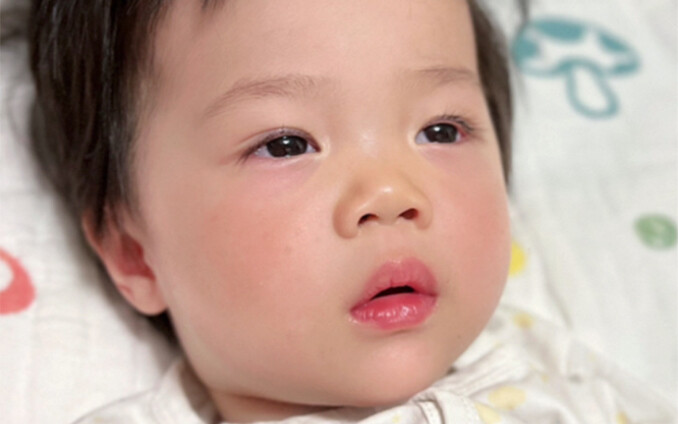 Bayi berusia 1 tahun 4 bulan melawan COVID-19