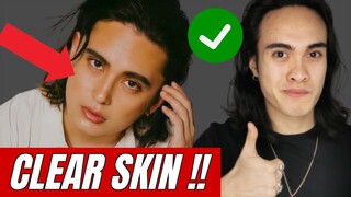 Paano Linisin Ang Mukha | Tips Kung Paano Maging Makinis Ang Mukha