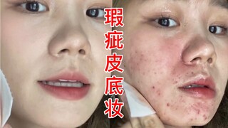 [Tips praktis dan praktis] 13 tahun riset mendalam tentang kulit berjerawat! Alas bedak dan riasan a