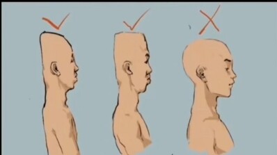 Did anyone’s head get flattened when they were little?