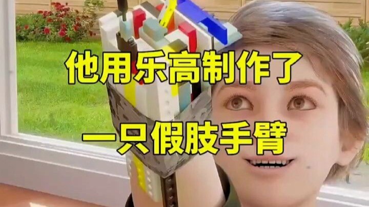 رغم الإعاقة، إرادته قوية وروحه مرحة؛ يبني بأناقة أطرافًا اصطناعية تُسعِفُ الجميع. قلبه مفعم بالرحمة 