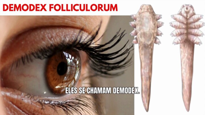 【Investigação】 Ácaros Ocultos e Extensões de Cílios: Os Riscos Secretos na Higiene Palpebral