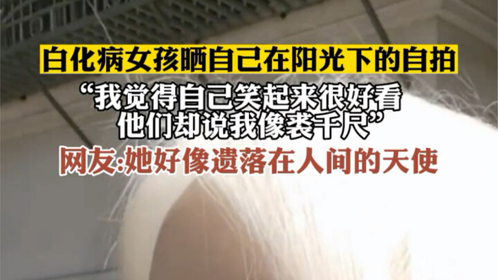 Gadis albino membagikan swafoto dirinya di bawah sinar matahari, “Menurutku senyumku terlihat sangat