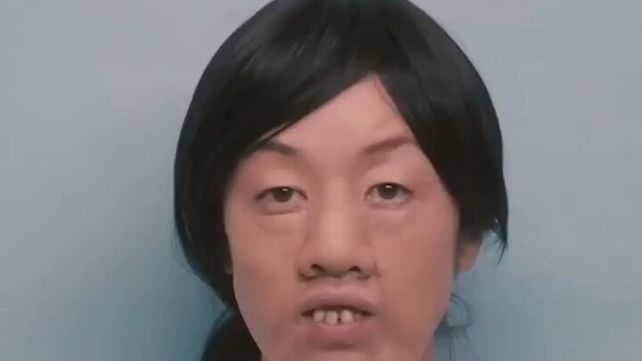 A deformed woman undergoes countless plastic surgeries to become a stunning beauty—she was truly ugl