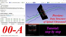 3D Slicer Lamina Landmark Labeling. #00-A. Preview -- data structure of spinal ultrasound