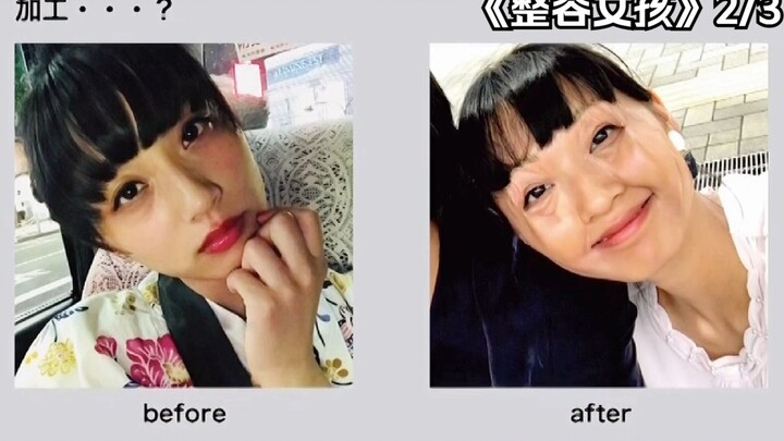 Cewek yang gila kecantikan sampai nekat! Pakai tang buat ngecilin wajah, hasilnya bikin ngilu lihatn