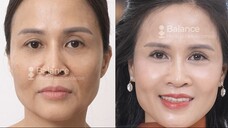 24.7.2025_TOAN_Xu Huong tre hoa_stt0018