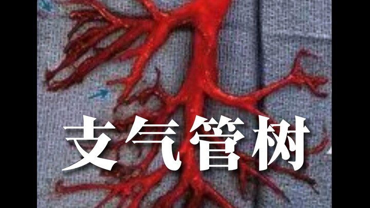 "Pohon" yang batuk keluar