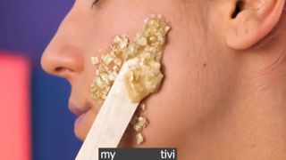 da nào bị mụn cho được p1 #mytivi