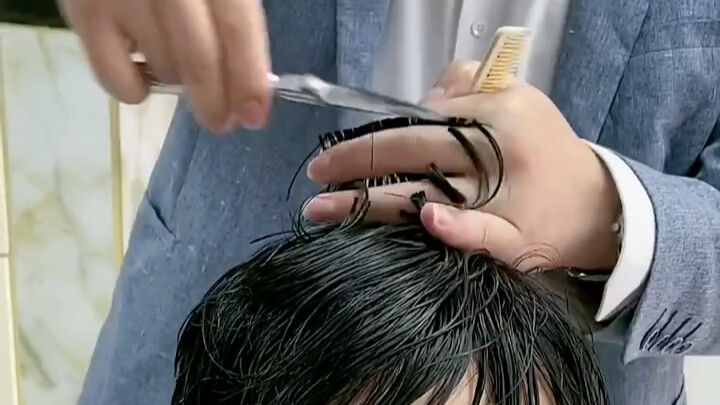 For male hair loss, customization based on the extent of the bald area and hair thickness yields mor