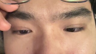 Thẩm mỹ trẻ trung hiện nay đáng sợ quá!